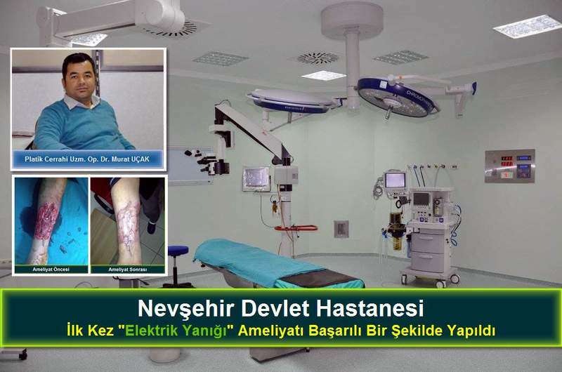 Nevşehir Devlet Hastanesinde İlk Kez “Elektirik Yanığı” Ameliyatı Yapıldı